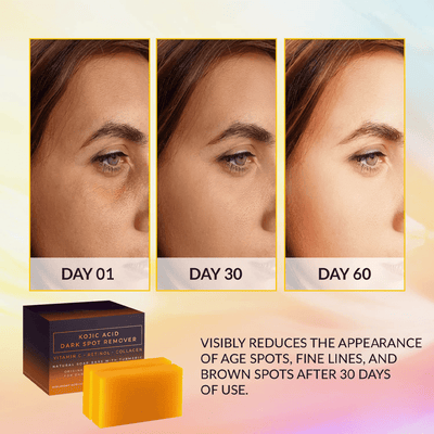 Kojic - Acid Dark Spot Remover Soap Bars™ - Faisly